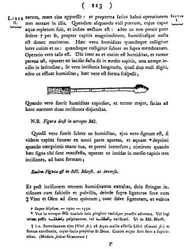 albucasis scalpel