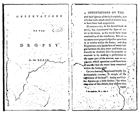 whytt dropsy brain